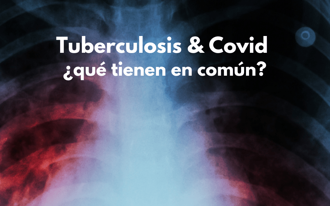Tuberculosis & COVID: ¿qué tienen en común?